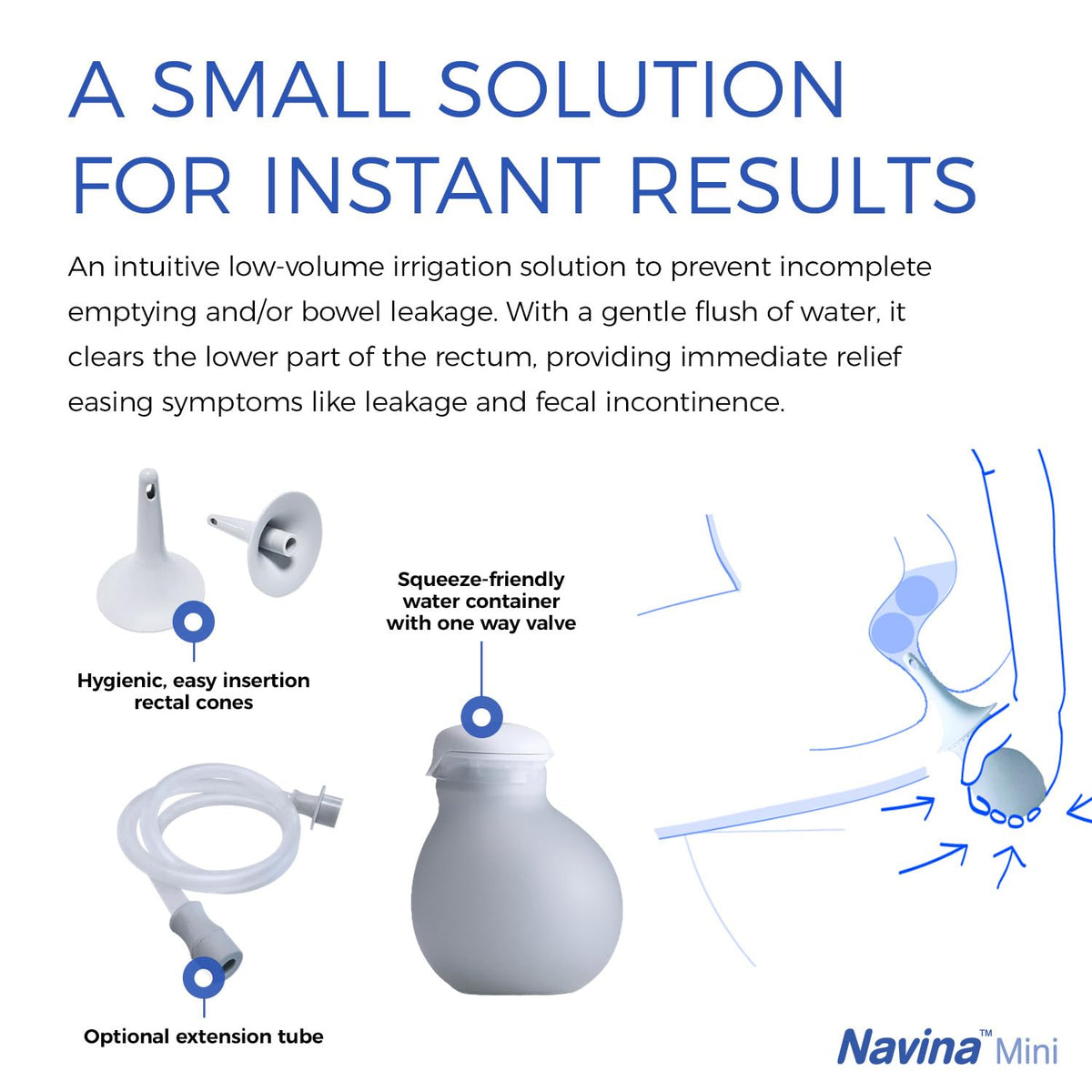 Low-Volume Enema Irrigation System with Water Bulb, Extension Tube, and 5 Rectal Cones O729